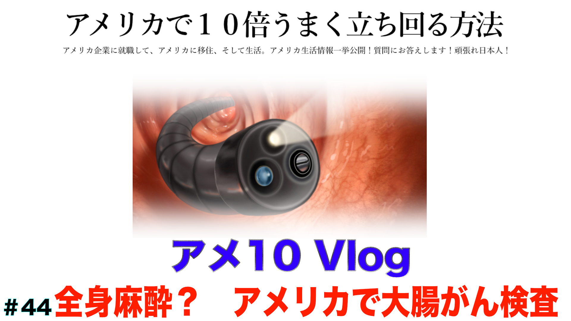 【アメ10 Vlog】マジ全身麻酔？　アメリカで大腸がん検査